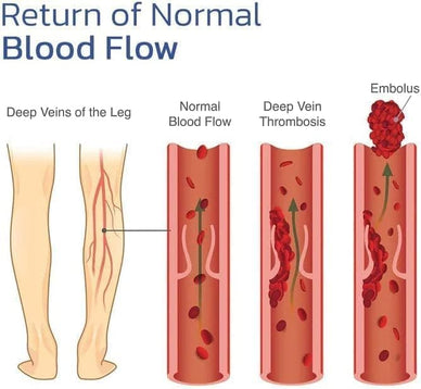 Rediscover Movement and Embrace Life's Joys!